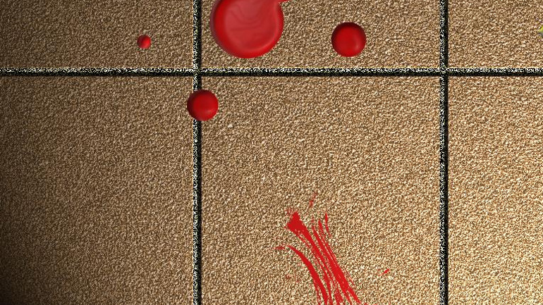 Πάτρα: Τον μαχαίρωσε για να του αρπάξει το κινητό