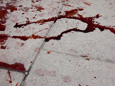 Άναψαν τα αίματα στο βόρειο Ισραήλ