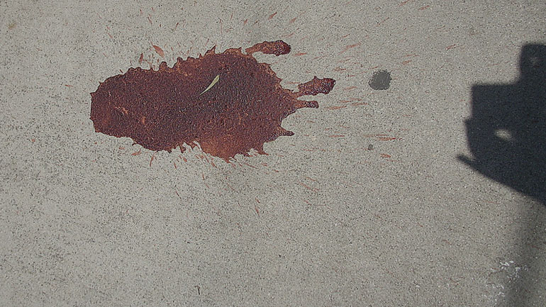 Αχαΐα: Τροχαίο με παράσυρση πεζού στη Λακκόπετρα