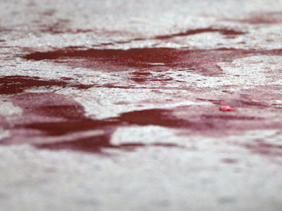 Ηλικιωμένος τραυμάτισε με όπλο έναν 17χρονο