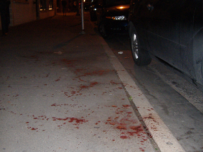 Λάρισα: Παρέσυρε ηλικιωμένη με το ΙΧ και την εγκατάλειψε!