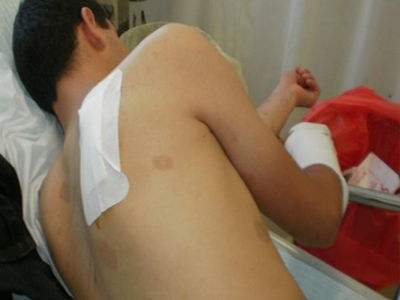 Χτύπησαν και λήστεψαν άστεγους μετανάστες στα Χανιά