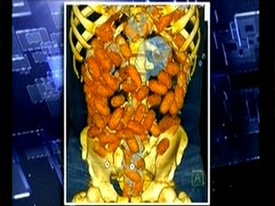 Κατάπιε ένα κιλό κοκαΐνη!