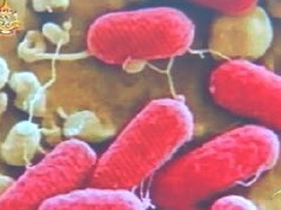 Προληπτικά μέτρα στην Ταϊλάνδη έλεω…Ε coli