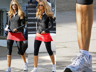 Το ατύχημα της Elle Macpherson