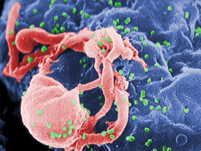 Στα σκαριά επαναστατική μέθοδος για την καταπολέμηση του HIV