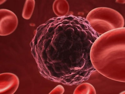 Πειραματικό φάρμακο μείωσε την «κακή» χοληστερόλη Πειραματικό φάρμακο μείωσε την «κακή» χοληστερόλη