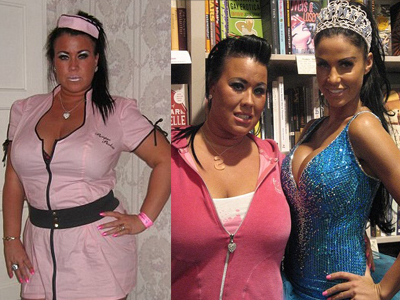 Πρέπει να χάσει βάρος