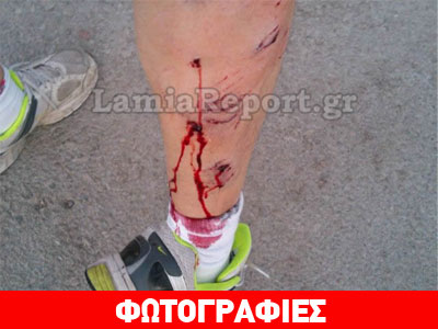 Λαμία: Άνθρωπος τραυματίστηκε από επίθεση σκύλου