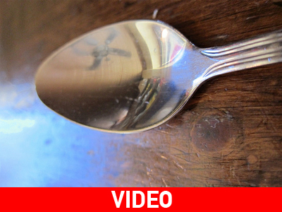 Μεξικό: Μόνιμη τύφλωση για 5χρονο αγγελούδι