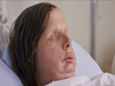 Στη δημοσιότητα το «νέο» πρόσωπο της Charla Nash