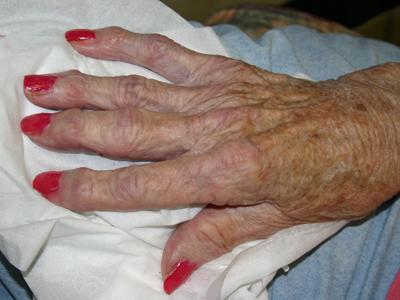 Νεαροί λήστεψαν ηλικιωμένη στον Εύοσμο