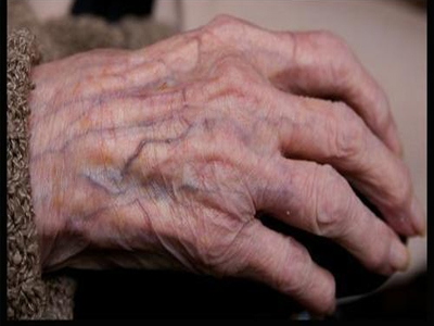 Τέλος καλό όλα κάλα με ηλικιωμένους ασθενείς