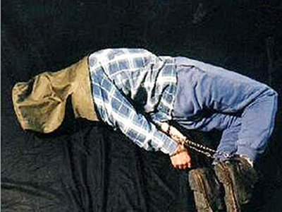 Θύμα βασανισμού Παλαιστίνιος κρατούμενος