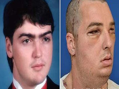 Ομαλή η ανάρρωση του Richard Norris