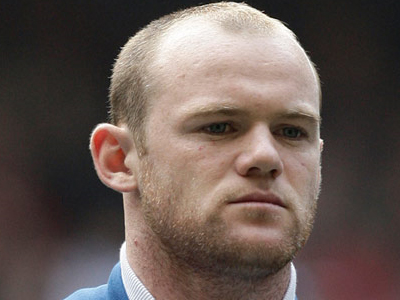 Έκανε μεταμόσχευση μαλλιών