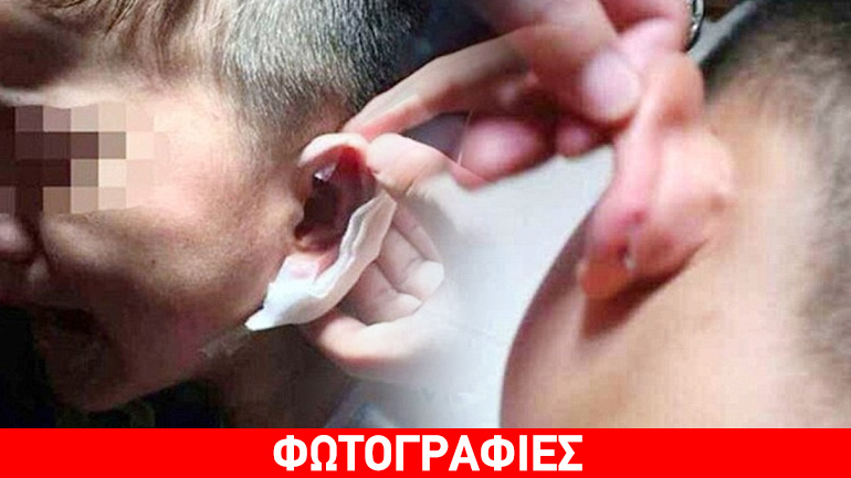 Κίνα: Δάσκαλος τρύπησε με… συρραπτικό το αυτί μαθητή!