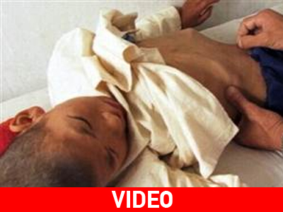 Αντιμέτωπη με την πείνα η Β. Κορέα