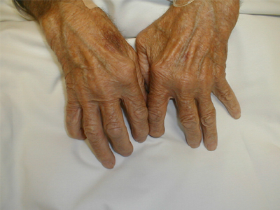 Πνιγμός 76χρονου στα Κύθηρα