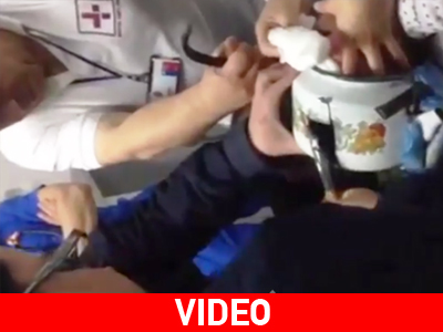 Χιλή: Κεφάλι κοριτσιού σφήνωσε σε… τσαγιέρα!