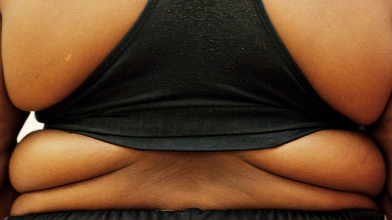 Οι παχύσαρκες γυναίκες κινδυνεύουν περισσότερο από καρκίνο