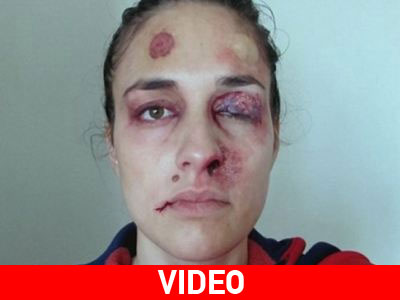 Ένας χρόνος κακοποίησης μέσα σε ένα λεπτό