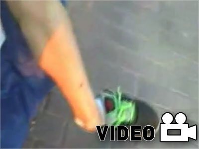 Έσπασε τον αστράγαλό του κάνοντας skateboard