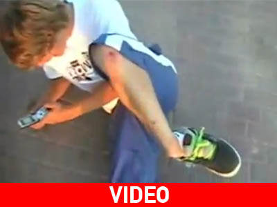 Έκανε skateboard και έσπασε τον αστράγαλό του