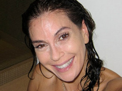 Δεν έχω κάνει botox και ιδού!