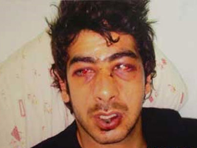 Αποζημίωση 300.000 ευρώ για την υπόθεση της ζαρντινιέρας