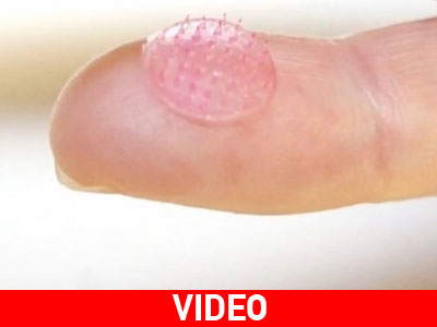 Τέλος στις ενέσεις με τις μικροβελόνες αποξηραμένης ζάχαρης!